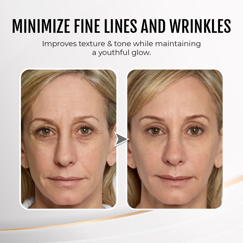 NESLEMY Eye Cream | NAD+ Retinol Volumetox Eye Cream | Firming, Wrinkles, Fine Lines, Dark Circles, Puffy | Retinol, Peptides, Niacinamide | Undereye Treatment Serum | 0.33 fl. oz.