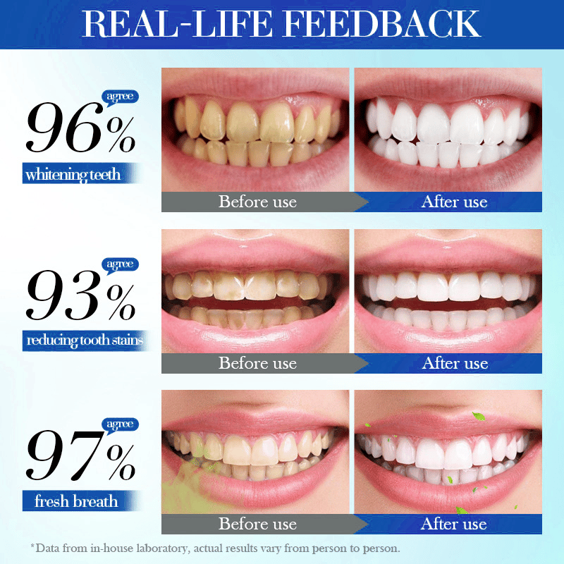 💥Hot Listing 🔥Alisanda Hydroxyapatite Toothpaste 7.5% for Enamel Repair & Teeth Whitening Refreshing Flavor Fluorid