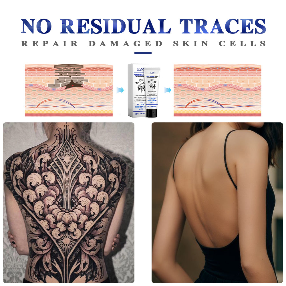 💖Limited time discount sale🚀 - HZA™ Tattoo Dissolving Gel