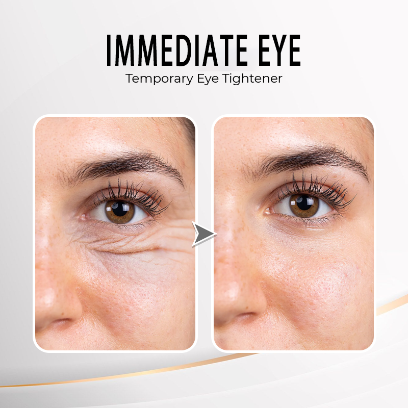 NESLEMY  Eye Cream | NAD+ Retinol Volumetox Eye Cream | Firming, Wrinkles, Fine Lines, Dark Circles, Puffy | Retinol, Peptides, Niacinamide | Undereye Treatment Serum | 0.33 fl. oz.