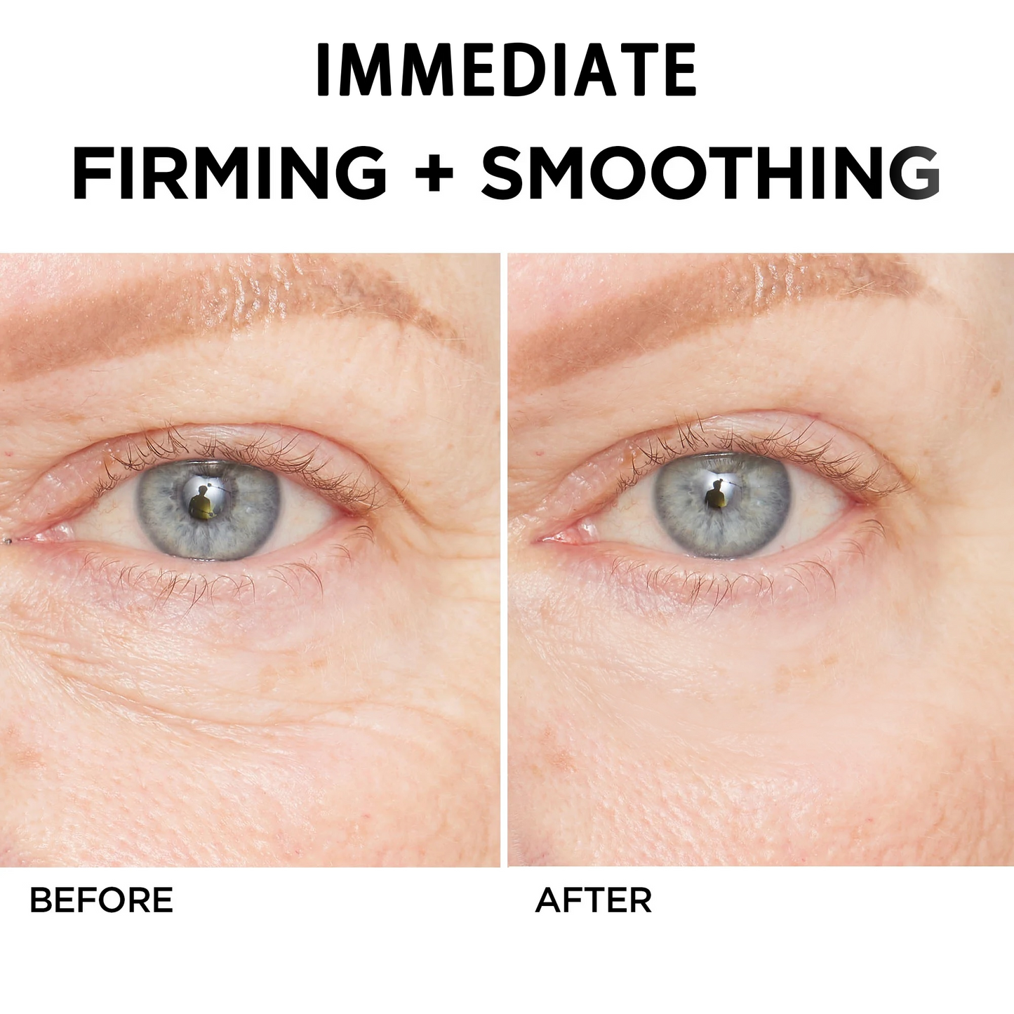 NESLEMY  Eye Cream | NAD+ Retinol Volumetox Eye Cream | Firming, Wrinkles, Fine Lines, Dark Circles, Puffy | Retinol, Peptides, Niacinamide | Undereye Treatment Serum | 0.33 fl. oz.