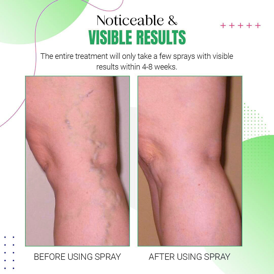 BBOJI™ Purslane Extract Conditioning Spray